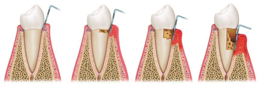 Лечение зубов в луганске под общим наркозом