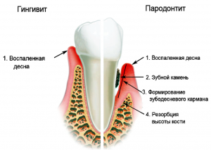 Лечение зубов в луганске под общим наркозом thumbnail